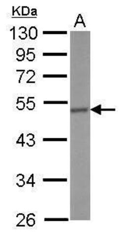 CRHR1 Polyclonal Antibody, Invitrogen 100 &mu;L; Unconjugated:Antibodies,