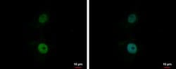 Invitrogen BCL7A Polyclonal Antibody 100 &mu;L; Unconjugated:Antibodies,