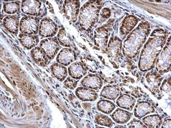 Invitrogen BCL7A Polyclonal Antibody 100 &mu;L; Unconjugated:Antibodies,