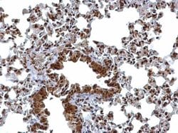 Invitrogen BCL7A Polyclonal Antibody 100 &mu;L; Unconjugated:Antibodies,