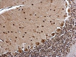 Invitrogen BCL7A Polyclonal Antibody 100 &mu;L; Unconjugated:Antibodies,