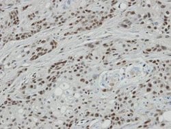 Invitrogen BCL7A Polyclonal Antibody 100 &mu;L; Unconjugated:Antibodies,