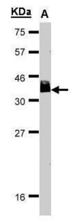 Invitrogen BCL7A Polyclonal Antibody 100 &mu;L; Unconjugated:Antibodies,