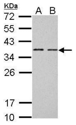 Invitrogen BCL7A Polyclonal Antibody 100 &mu;L; Unconjugated:Antibodies,