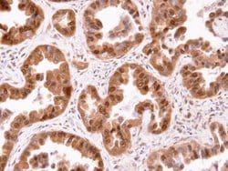 Invitrogen CIS Polyclonal Antibody 100 &mu;L; Unconjugated:Antibodies,