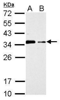Invitrogen CIS Polyclonal Antibody 100 &mu;L; Unconjugated:Antibodies,