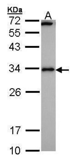 Invitrogen RCAN1 Polyclonal Antibody 100 &mu;L | Buy Online | Invitrogen&trade; | Fisher Scientific