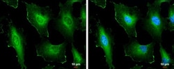 Invitrogen Cortactin Polyclonal Antibody 100 μL; Unconjugated:Antibodies,