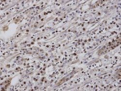 Invitrogen EAR2 Polyclonal Antibody 100 &mu;L; Unconjugated:Antibodies,