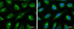 ACSL4 Polyclonal Antibody, Invitrogen 100 &mu;L; Unconjugated:Antibodies,