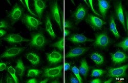 ACSL4 Polyclonal Antibody, Invitrogen 100 &mu;L; Unconjugated:Antibodies,