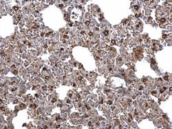 ACSL4 Polyclonal Antibody, Invitrogen 100 &mu;L; Unconjugated:Antibodies,
