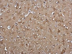 ACSL4 Polyclonal Antibody, Invitrogen 100 &mu;L; Unconjugated:Antibodies,