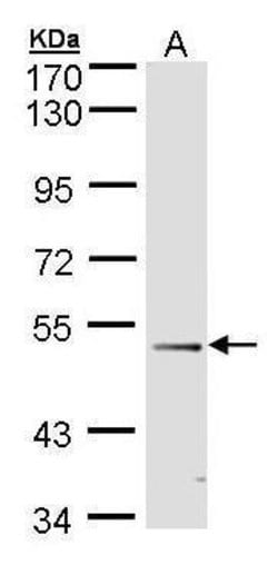 FOXD1 Polyclonal Antibody, Invitrogen 100 μL; Unconjugated:Antibodies,