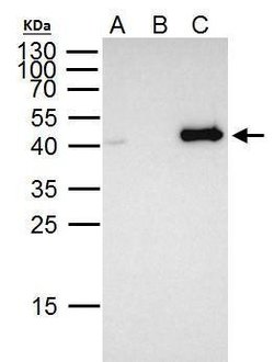 Invitrogen FOXE1 Polyclonal Antibody 100 &mu;L; Unconjugated:Antibodies,