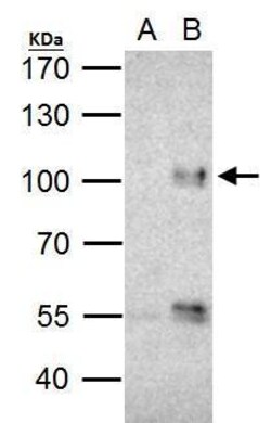 Invitrogen FOXO3A Polyclonal Antibody 100 μL; Unconjugated:Antibodies,