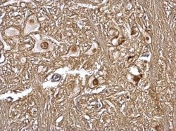 Invitrogen GPS1 Polyclonal Antibody 100 &mu;L; Unconjugated:Antibodies,