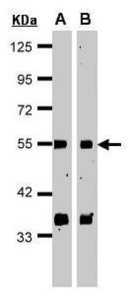 Invitrogen GPS1 Polyclonal Antibody 100 &mu;L; Unconjugated:Antibodies,