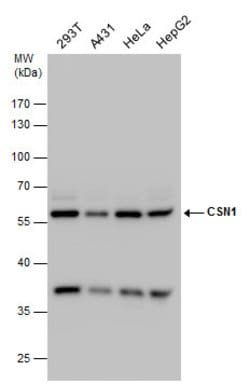 Invitrogen GPS1 Polyclonal Antibody 100 &mu;L; Unconjugated:Antibodies,
