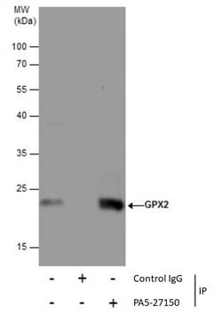Invitrogen GPX2 Polyclonal Antibody 100 &mu;L | Buy Online | Invitrogen&trade; | Fisher Scientific