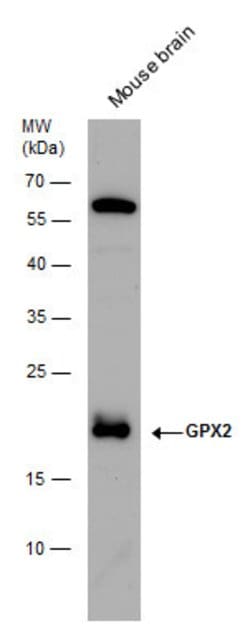 Invitrogen GPX2 Polyclonal Antibody 100 &mu;L | Buy Online | Invitrogen&trade; | Fisher Scientific