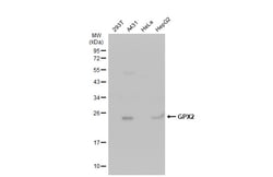 Invitrogen GPX2 Polyclonal Antibody 100 &mu;L | Buy Online | Invitrogen&trade; | Fisher Scientific