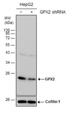 Invitrogen GPX2 Polyclonal Antibody 100 &mu;L | Buy Online | Invitrogen&trade; | Fisher Scientific