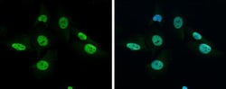 Invitrogen GRB2 Polyclonal Antibody 100 &mu;L; Unconjugated:Antibodies,