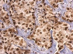 Invitrogen GRB2 Polyclonal Antibody 100 &mu;L; Unconjugated:Antibodies,