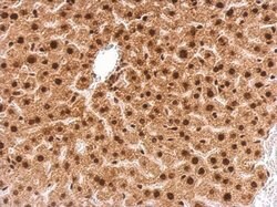 Invitrogen GRB2 Polyclonal Antibody 100 &mu;L; Unconjugated:Antibodies,