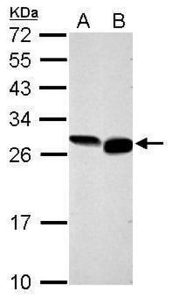 Invitrogen GRB2 Polyclonal Antibody 100 &mu;L; Unconjugated:Antibodies,