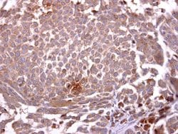Invitrogen CD235a Polyclonal Antibody 100 &mu;L; Unconjugated:Antibodies,