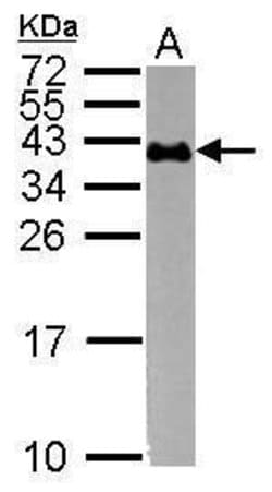Invitrogen CD235a Polyclonal Antibody 100 &mu;L; Unconjugated:Antibodies,