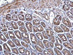 Invitrogen ERAB Polyclonal Antibody 100 &mu;L; Unconjugated:Antibodies,