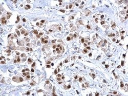 Invitrogen FOXA1 Polyclonal Antibody 100 &mu;L | Buy Online | Invitrogen&trade; | Fisher Scientific