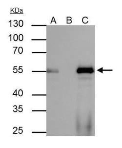 Invitrogen FOXA1 Polyclonal Antibody 100 &mu;L | Buy Online | Invitrogen&trade; | Fisher Scientific