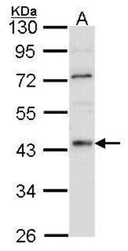 Invitrogen HNF4A Polyclonal Antibody 100 &mu;L | Buy Online | Invitrogen&trade; | Fisher Scientific