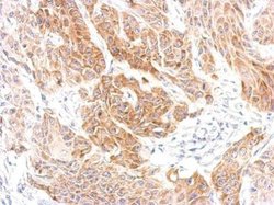 CXCR6 Polyclonal Antibody, Invitrogen 100 μL; Unconjugated:Antibodies,