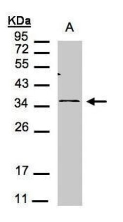 CXCR6 Polyclonal Antibody, Invitrogen 100 μL; Unconjugated:Antibodies,