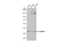 GPR146 Polyclonal Antibody, Invitrogen 100 &mu;L; Unconjugated:Antibodies,