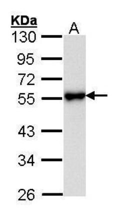 KISS1R Polyclonal Antibody, Invitrogen 100 &mu;L; Unconjugated:Antibodies,