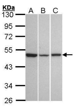 Invitrogen KISS1R Polyclonal Antibody 100 &mu;L; Unconjugated:Antibodies,