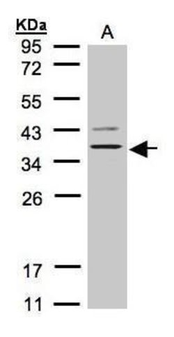 P2Y13 Polyclonal Antibody, Invitrogen 100 μL; Unconjugated:Antibodies,