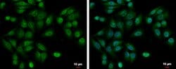 Invitrogen UBE2A Polyclonal Antibody 100 μL; Unconjugated:Antibodies,
