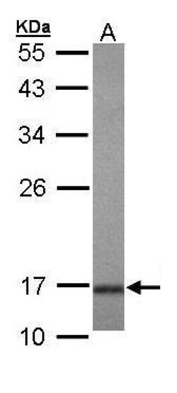 Invitrogen UBE2A Polyclonal Antibody 100 μL; Unconjugated:Antibodies,