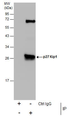 Invitrogen p27 Kip1 Polyclonal Antibody 100 &mu;L; Unconjugated:Antibodies,