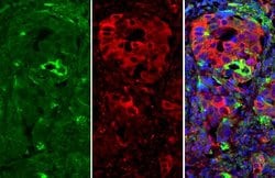 Invitrogen ICAM-1 Polyclonal Antibody 100 &mu;L; Unconjugated:Antibodies,
