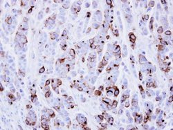 Invitrogen ICAM-1 Polyclonal Antibody 100 &mu;L; Unconjugated:Antibodies,
