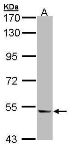 Invitrogen ICAM-1 Polyclonal Antibody 100 &mu;L; Unconjugated:Antibodies,