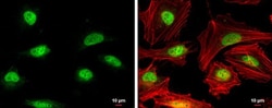 Invitrogen RAD51 Polyclonal Antibody 100 &mu;L; Unconjugated:Antibodies,